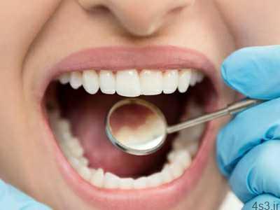 ۶ راه کارآمد برای از بین بردن پلاک دندان به طور طبیعی