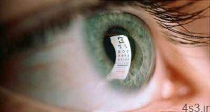 آيا عمل ليزيک چشم مفيد است؟ سایت 4s3.ir