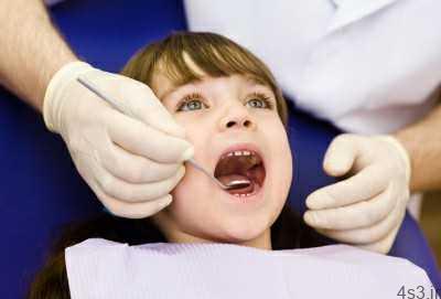 فیشورسیلانت و فواید آن برای دندان دائمی