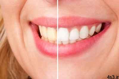 ۷ توصیه برای درست تمیز کردن دندانها