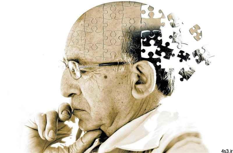 آیا می‌توان از ابتلا به بیماری آلزایمر پیشگیری کرد؟