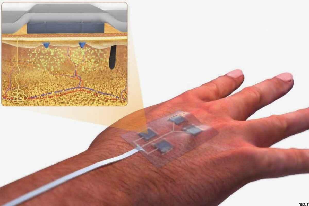 خبرهای پزشکی : ابداع بانداژ کنترل از راه دور برای التیام زخم‌های مزمن