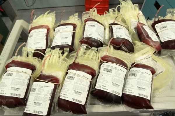 خبرهای پزشکی : افزایش احتمال لختگی خون در گروه های خونی A و B
