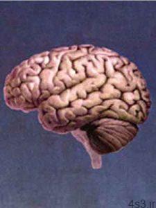 اولین علامت نیمی از تومورهای مغزی را بدانید سایت 4s3.ir