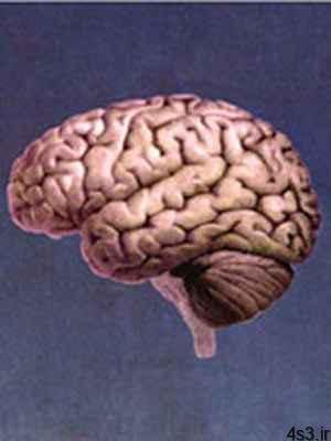 اولین علامت نیمی از تومورهای مغزی را بدانید