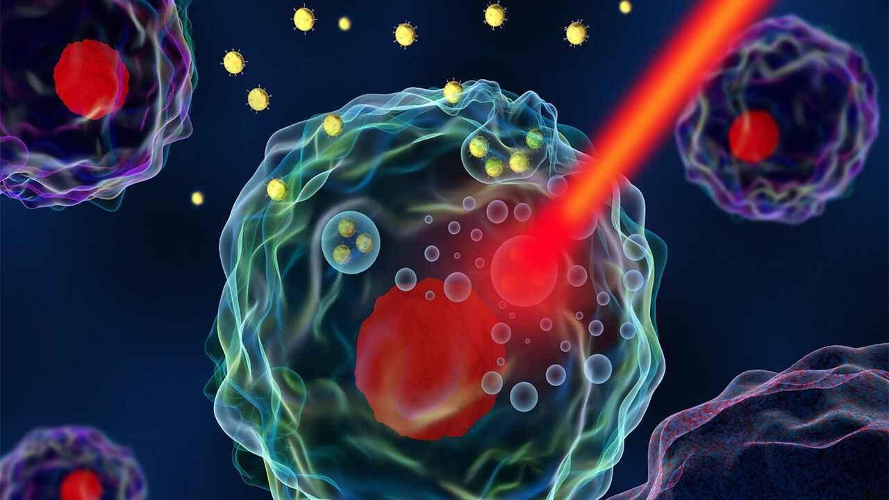 خبرهای پزشکی : تشخیص زودهنگام سرطان با نانوذرات طلا