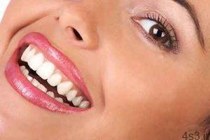 خدمات دندانپزشکی شامل چه مواردی است؟ سایت 4s3.ir