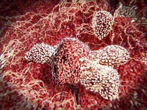 خبرهای پزشکی : درمان همه انواع سرطان با کشف نوع جدیدی از سلول ایمنی سایت 4s3.ir