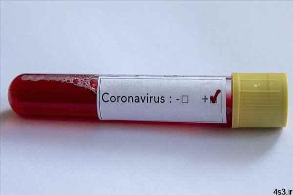 خبرهای پزشکی : درمان ویروس کرونا با پلاسمای خون افراد بهبود یافته