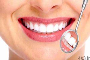 رازهایی از زیبایی و سلامت دندان که قبلا جایی نشنیده‌اید سایت 4s3.ir