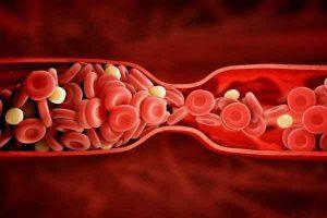 خبرهای پزشکی : سندروم متابولیک موجب بروز مجدد لختگی خون می شود سایت 4s3.ir