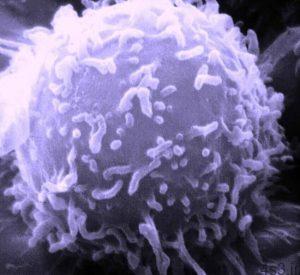 خبرهای پزشکی : شنود ارتباطات سلول‌های سرطانی سایت 4s3.ir
