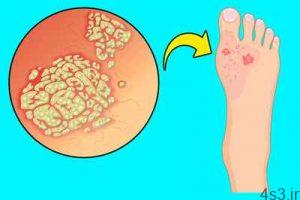 علامتهایی در پاها که نشان دهنده مشکلات داخلی بدن هستند سایت 4s3.ir