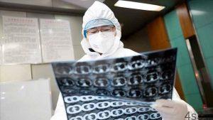 خبرهای پزشکی : قربانیان ویروس کرونا در چین به ۵۶ نفر افزایش یافت سایت 4s3.ir