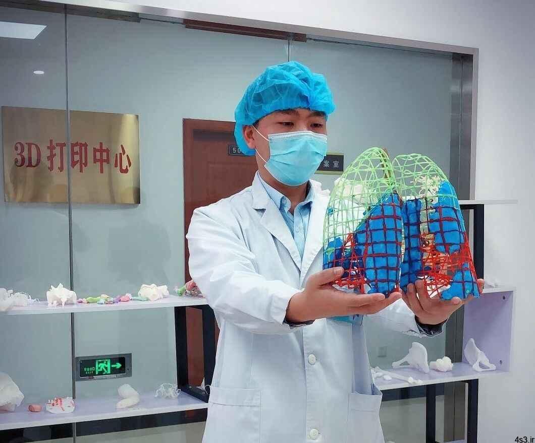 خبرهای پزشکی : ماکت ریه آلوده به کرونا در چین ساخته شد