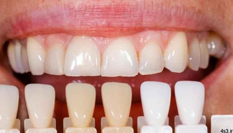 مراحل انجام کار دندانپزشک زیبایی چیست؟
