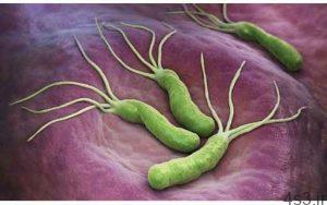خبرهای پزشکی : میکروب معده بیماری عفونی، قابل انتقال به دیگران سایت 4s3.ir