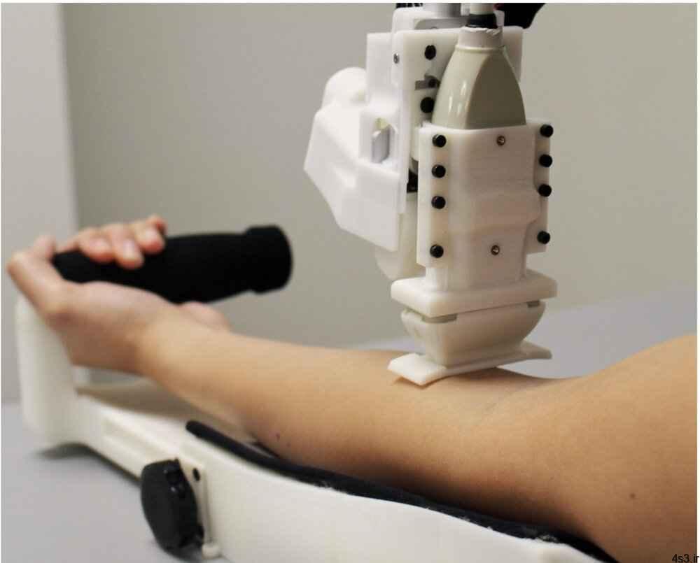 خبرهای پزشکی : نخستین آزمایش ربات نمونه‌گیر خون روی انسان، با موفقیت انجام شد