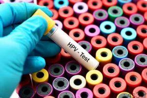 خبرهای پزشکی : نرخ ۵ تا ۹ درصدی ابتلا به HPV در کشور/تاثیر آلودگی هوا در فوت زودتر شهروندان سایت 4s3.ir