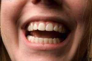 پیشگیری از مشکلات دهانی دندانی سایت 4s3.ir