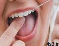 چطور دندان هایتان را سفید کنید؟ سایت 4s3.ir