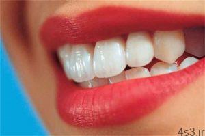 چگونه دندان های شفاف و براقی داشته باشیم؟ سایت 4s3.ir