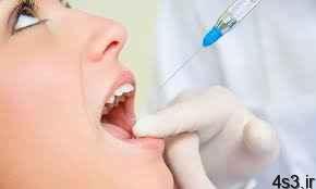 مواد بی حسی دندانپزشکی روزه را باطل می کند؟ سایت 4s3.ir