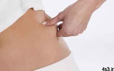درمان شلی و افتادگی پوست بعد از کاهش وزن با ورزش