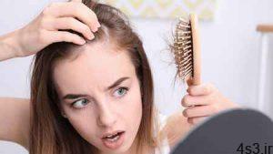 برای جلوگیری از ریزش مو چه باید خورد؟ سایت 4s3.ir