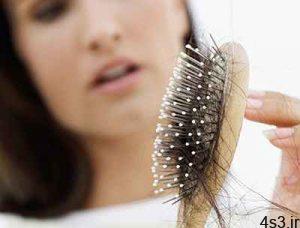 درمان فوری و جلوگیری از ریزش مو سر سایت 4s3.ir