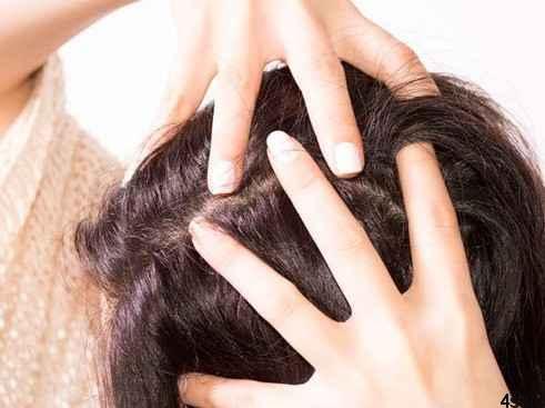 درمان هایی فوق العاده علیه ریزش مو