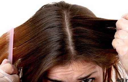 راههای کم هزینه و موثر برای درمان ریزش مو
