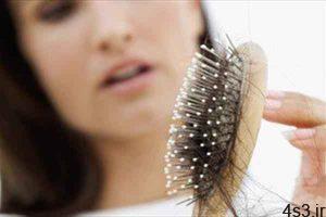 ریزش مو در تابستان به چه دلیلی است؟ سایت 4s3.ir