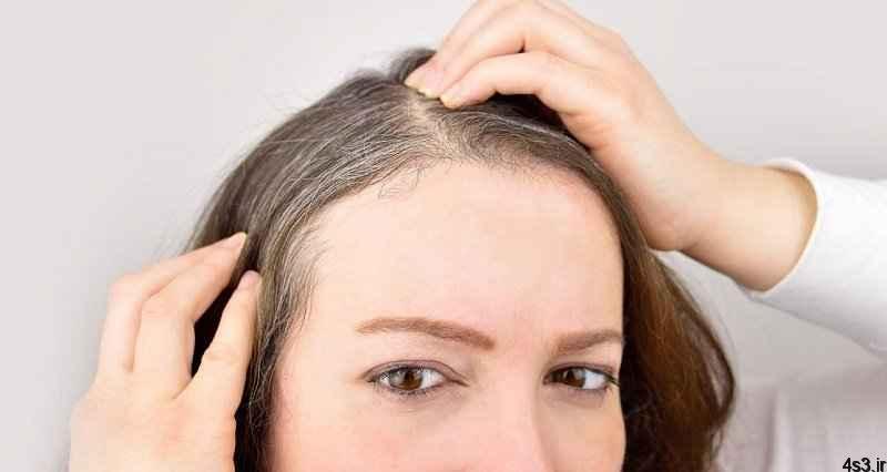 علت سفید شدن موها و راههای درمان آن