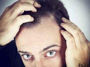 علت و درمان ریزش مو در مردان سایت 4s3.ir
