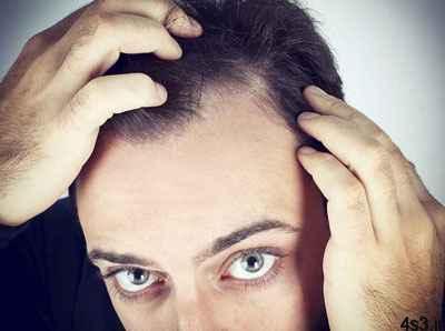 علت و درمان ریزش مو در مردان