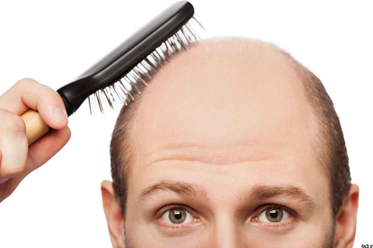 هشت دلیل چرب شدن موها چیست ؟