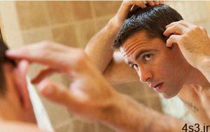 ویتامین های ضروری برای رشد و تقویت مو در آقایان سایت 4s3.ir