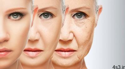 5 علتی که سبب پیری زودرس خانم ها می شود