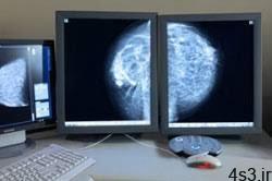 ماموگرافی به چه دردی می خورد؟ سایت 4s3.ir