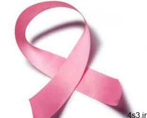 نشانه های سرطان سینه چیست؟ سایت 4s3.ir